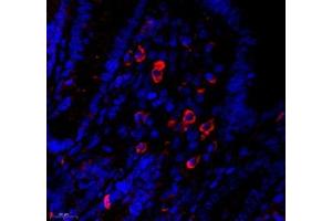 Immunofluorescence of paraffin embedded mouse appendix using MS4A2 (ABIN7074594) at dilution of 1: 400 (550x lens) (MS4A2 抗体)