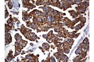 Image no. 1 for anti-BCL2/adenovirus E1B 19kDa Interacting Protein 1 (BNIP1) (AA 1-199) antibody (ABIN1490605) (BNIP1 抗体  (AA 1-199))