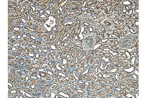 Immunohistochemistry (IHC) image for anti-STIP1 Homology and U-Box Containing Protein 1 (STUB1) (C-Term) antibody (ABIN184697)