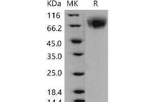 Western Blotting (WB) image for Lysosomal-Associated Membrane Protein 2 (LAMP2) protein (His tag) (ABIN7320146)