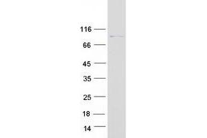 Western Blotting (WB) image for RAP1 GTPase Activating Protein (RAP1GAP) (Transcript Variant 3) protein (Myc-DYKDDDDK Tag) (ABIN2730475)