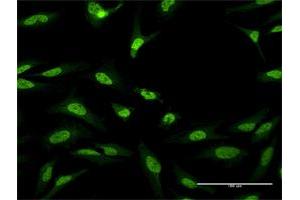 Immunofluorescence of purified MaxPab antibody to CUGBP1 on HeLa cell. (CELF1 抗体  (AA 1-483))