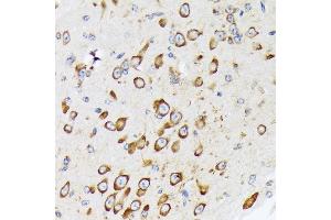 Immunohistochemistry of paraffin-embedded mouse brain using RPS20 Rabbit mAb (ABIN7270017) at dilution of 1:100 (40x lens). (RPS20 抗体)
