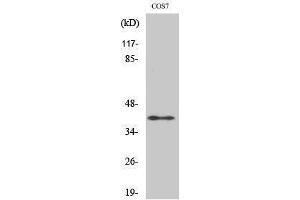 Western Blotting (WB) image for anti-Alcohol Dehydrogenase 7 (Class IV), mu Or sigma Polypeptide (ADH7) (Internal Region) antibody (ABIN3173698) (ADH7 抗体  (Internal Region))