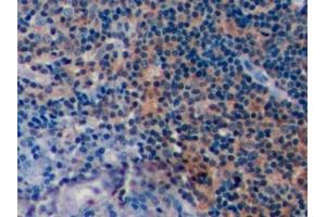 Immunohistochemistry (IHC) image for anti-CD19 Molecule (CD19) (AA 160-258) antibody (ABIN7434245)