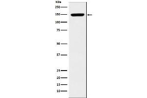 Western blot analysis of p150 CAF1 expression in K562 cell lysate. (Recombinant CHAF1A 抗体)