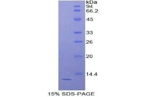 SDS-PAGE analysis of Mouse DBI Protein. (Diazepam Binding Inhibitor Protein (DBI))