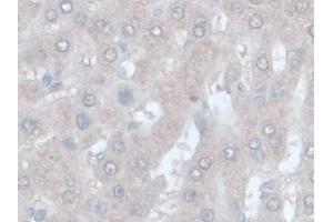 IHC-P analysis of Rat Liver Tissue, with DAB staining. (ORM1 抗体  (AA 19-186))