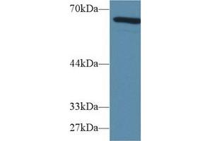 Detection of AFP in Mouse Lung lysate using Polyclonal Antibody to Alpha-Fetoprotein (AFP) (alpha Fetoprotein 抗体  (AA 399-605))