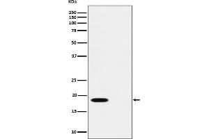 anti-6-Pyruvoyltetrahydropterin Synthase (PTS) (pSer19) antibody