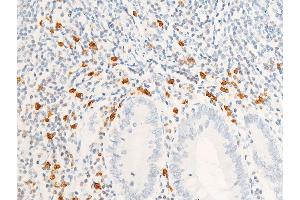 Immunohistochemistry (IHC) image for anti-Receptor tyrosine-protein kinase erbB-2 (ErbB2/Her2) (pTyr1112) antibody (ABIN6255774)