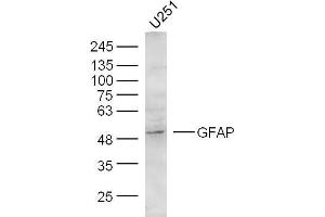 U251 Cells lysates probed with GFAP Polyclonal Antibody, unconjugated  at 1:300 overnight at 4°C followed by a conjugated secondary antibody at 1:10000 for 60 minutes at 37°C. (GFAP 抗体  (AA 51-150))