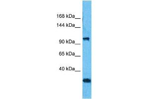 Western Blotting (WB) image for anti-MORC Family CW-Type Zinc Finger 3 (MORC3) (C-Term) antibody (ABIN5517173)