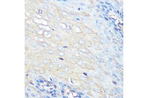 Immunohistochemistry of paraffin-embedded human esophageal using CCR7 Rabbit mAb (ABIN7266309) at dilution of 1:100 (40x lens). (CCR7 抗体)