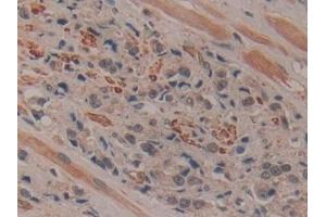 Immunohistochemistry (IHC) image for anti-Ribonuclease/angiogenin Inhibitor 1 (RNH1) (AA 218-444) antibody (ABIN7440089)
