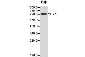 Western blot analysis of extracts of Raji cell lines, using SYK antibody. (SYK 抗体)
