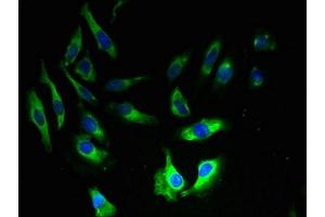 Immunofluorescent analysis of Hela cells using ABIN7144373 at dilution of 1:100 and Alexa Fluor 488-congugated AffiniPure Goat Anti-Rabbit IgG(H+L) (AP2S1 抗体  (AA 1-142))