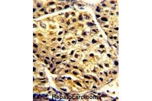 Immunohistochemistry (IHC) image for anti-Arylacetamide Deacetylase (Esterase) (AADAC) antibody (ABIN3002812) (AADAC 抗体)