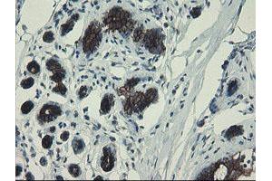 Immunohistochemical staining of paraffin-embedded Human breast tissue using anti-DPH2 mouse monoclonal antibody. (DPH2 抗体)