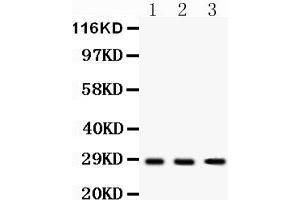 Western Blotting (WB) image for anti-Dickkopf 2 Homolog (DKK2) (AA 34-259) antibody (ABIN3043565) (DKK2 抗体  (AA 34-259))