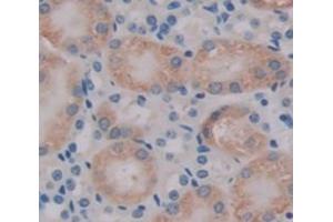 Used in DAB staining on fromalin fixed paraffin- embedded kidney tissue (TMOD3 抗体  (AA 1-352))