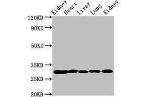 Western Blot Positive WB detected in: Rat kidney tissue, Rat heart tissue, Rat liver tissue, Mouse lung tissue, Mouse kidney tissue All lanes: CA2 antibody at 2 μg/mL Secondary Goat polyclonal to rabbit IgG at 1/50000 dilution Predicted band size: 30 kDa Observed band size: 30 kDa (CA2 抗体  (AA 2-260))