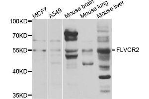 Western blot analysis of extracts of various cells, using FLVCR2 antibody. (FLVCR2 抗体)