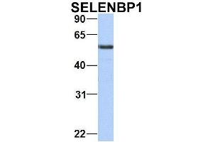 Western Blotting (WB) image for anti-Selenium Binding Protein 1 (SELENBP1) (C-Term) antibody (ABIN2783295)