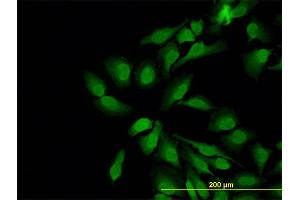Immunofluorescence of monoclonal antibody to WASL on HeLa cell. (Neural Wiskott-Aldrich syndrome protein (WASL) (AA 97-184) 抗体)