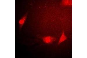 Immunofluorescent analysis of Sm E staining in Hela cells.