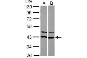 WB Image Sample (30 ug of whole cell lysate) A: 293T B: Raji 10% SDS PAGE antibody diluted at 1:10000 (HNRNPD/AUF1 抗体)