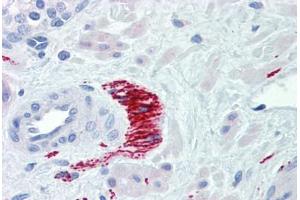 Human Prostate, Nerve (formalin-fixed, paraffin-embedded) stained with TH antibody ABIN462131 followed by biotinylated goat anti-rabbit IgG secondary antibody ABIN481713, alkaline phosphatase-streptavidin and chromogen. (Tyrosine Hydroxylase 抗体)