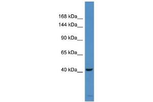Host:  Rabbit  Target Name:  DKFZp686H10114  Sample Type:  COLO205 Whole cell lysates  Antibody Dilution:  1. (DKFZp686H10114 (Middle Region) 抗体)