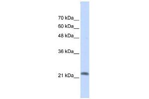 RASL10A antibody used at 1 ug/ml to detect target protein. (RASL10A 抗体  (N-Term))