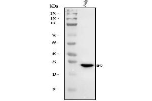 Western blot analysis of RPS2 using anti-RPS2 antibody (ABIN7601997).
