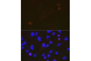 Immunofluorescence analysis of C6 cells using T Rabbit mAb (ABIN7270916) at dilution of 1:100 (40x lens). (TACC3 抗体)