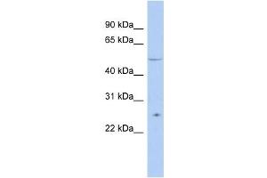 TTC8 antibody used at 1 ug/ml to detect target protein. (TTC8 抗体  (N-Term))