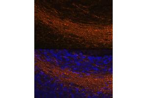Immunofluorescence analysis of rat brain using CNPase Rabbit mAb (ABIN7265322) at dilution of 1:100 (40x lens). (Cnpase 抗体)