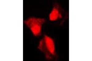 Immunofluorescence (IF) image for anti-Tumor Protein P53 (TP53) (C-Term), (pSer315) antibody (ABIN7297186)