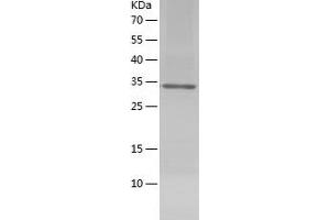 Western Blotting (WB) image for Dystroglycan 1 (DAG1) (AA 30-312) protein (His tag) (ABIN7122728) (Dystroglycan Protein (AA 30-312) (His tag))