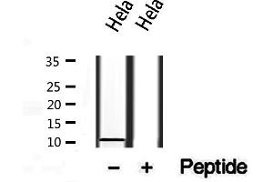 Western blot analysis of extracts from Hela, using S100A14 antibody. (S100A14 抗体  (N-Term))