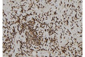 ABIN6277117 at 1/100 staining Human gastric tissue by IHC-P.
