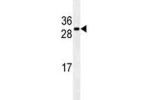 CDCA8 antibody western blot analysis in U251 lysate (CDCA8 抗体)