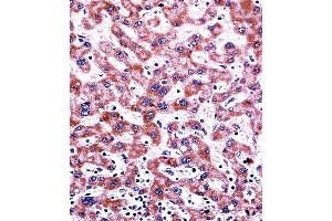 CYP2C9 Antibody immunohistochemistry analysis in formalin fixed and paraffin embedded human liver tissue followed by peroxidase conjugation of the secondary antibody and DAB staining. (CYP2C9 抗体  (N-Term))