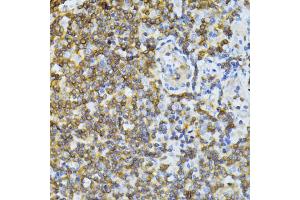 Immunohistochemistry of paraffin-embedded human tonsil using ND5 antibody (ABIN6294088) at dilution of 1:100 (40x lens). (MT-ND5 抗体)