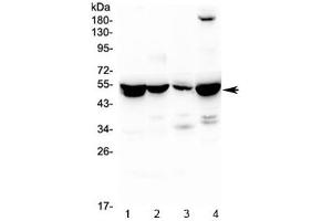 Western blot testing of 1) rat liver, 2) rat kidney, 3) rat lung and 4) mouse liver lysate with ASL antibody at 0. (Adenylosuccinate Lyase 抗体)