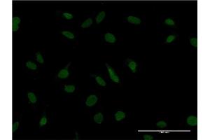 Immunofluorescence of monoclonal antibody to ZBTB20 on HeLa cell. (ZBTB20 抗体  (AA 451-542))