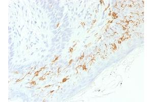 Formalin-fixed, paraffin-embedded human Skin stained with CD1a-Monospecific RecombinantRabbit Monoclonal Antibody (C1A/1506R). (Recombinant CD1a 抗体)