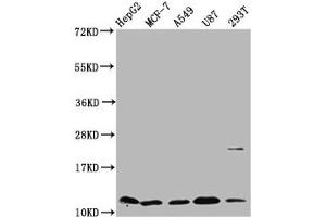 Western Blot Positive WB detected in: HepG2 whole cell lysate, MCF-7 whole cell lysate, A549 whole cell lysate, U87 whole cell lysate, 293T whole cell lysate All lanes: CSTB antibody at 5. (CSTB 抗体  (AA 1-98))