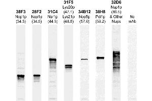 The Western blots of whole yeast protein extracts with a collection of our antibodies. (PDI1 抗体)